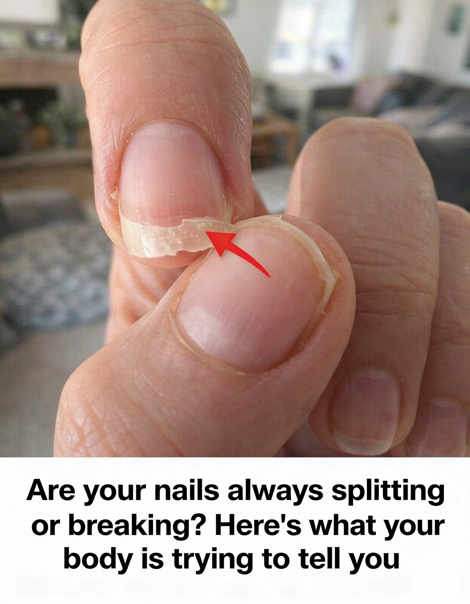 Brittle Nails? 10 Hidden Causes Your Body Is Desperately Trying to Tell You About – And How to Fix Them Fast