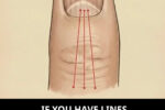 Lines on Your Fingernails: What They Might Reveal About Your Health