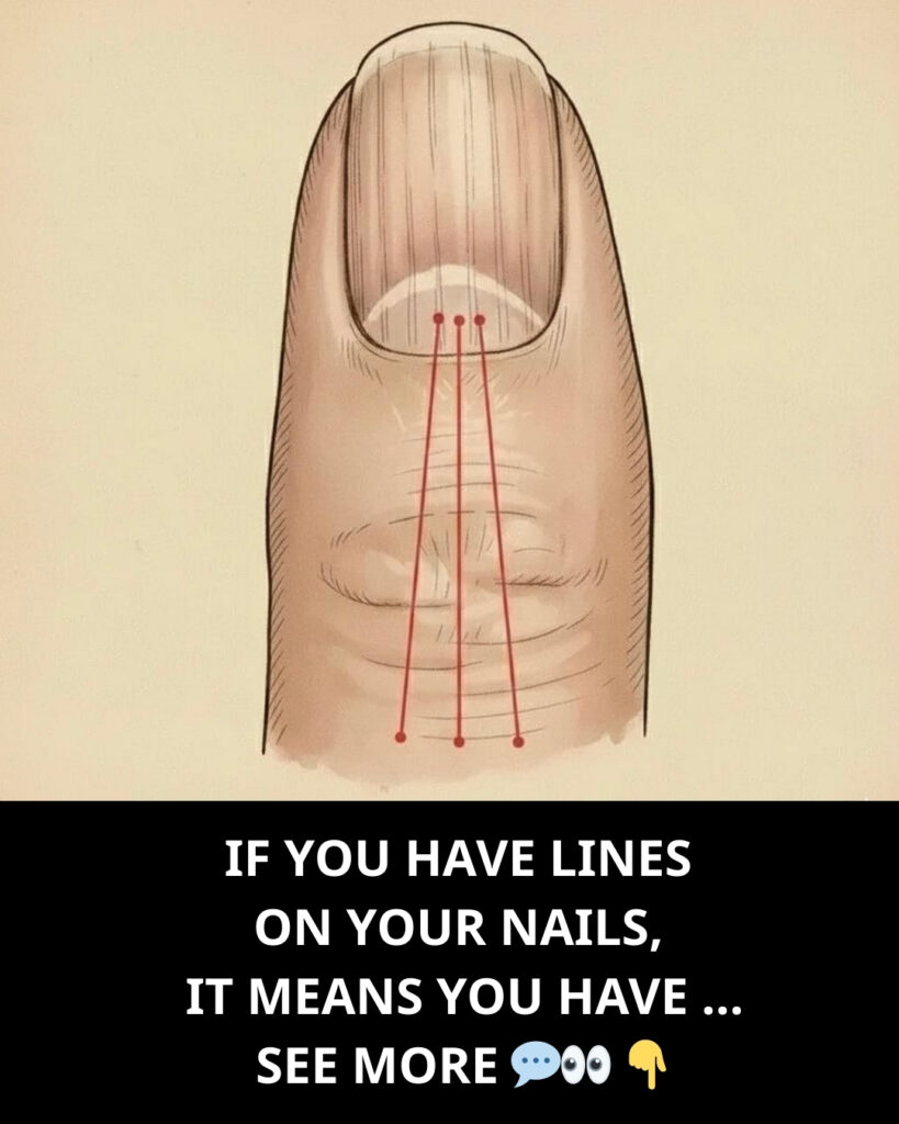Lines on Your Fingernails: What They Might Reveal About Your Health
