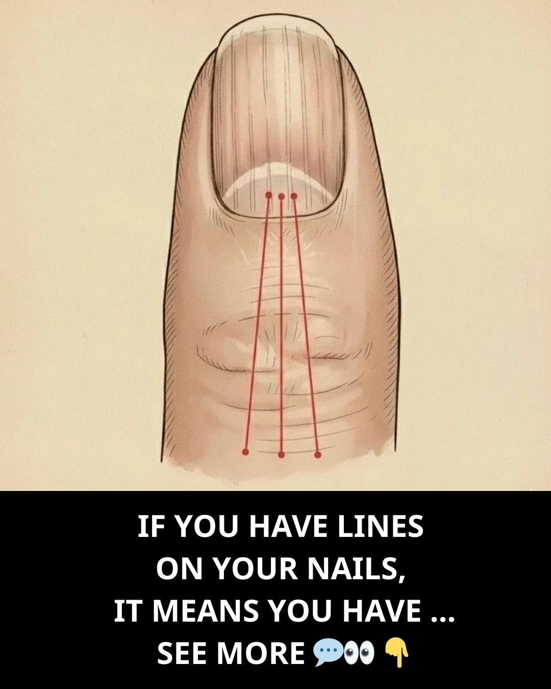 Lines on Your Fingernails: What They Might Reveal About Your Health