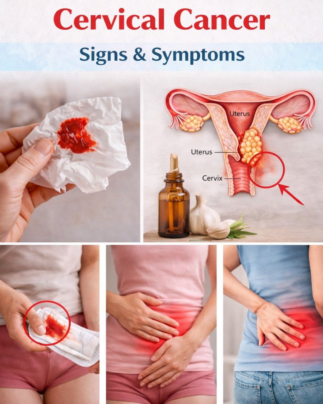 9 Early Warning Signs of Cervical Cancer Many Women Overlook (And Why They Matter)