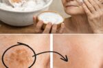Could Baking Soda Help Fade Age Spots? A Natural Approach Women Over 50 Are Exploring
