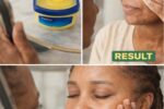The Best Way To Use Vaseline And Lemon On Skin For Clearing Dark Spots, Wrinkles & Get Glowing Skin