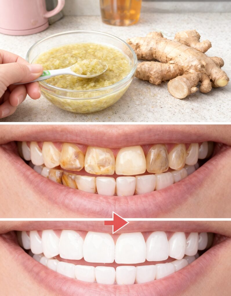 Whitening Teeth with Ginger: Before and After – What the Buzz Is Really About