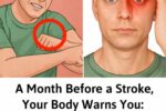 10 Warning Signs Your Body May Send a Month Before a Stroke – Don’t Ignore These Red Flags