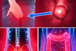 10 Quiet Warning Signs of Colon Cancer You’re Probably Ignoring Even If Doctors Miss Number 3