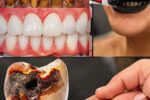 Simple Natural Tips to Keep Your Teeth Healthy: 5 Powerful Home Remedies That May Help Prevent Cavities and Reduce Dental Visits