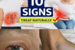 13 Early Signs of Kidney Failure You’re Ignoring Every Day (Symptoms That Could Save Your Life)