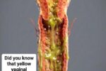 Yellow Vaginal Discharge: What It May Indicate About Your Health