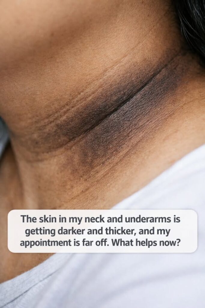 The skin in my neck and underarms is getting darker and thicker, and my appointment is far off. What helps now?