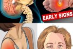 8 Warning Signs of Stroke That Can Appear Up to a Month Before + 9 Powerful, Evidence-Based Tips to Slash Your Risk