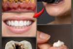Simple Natural Tips to Keep Your Teeth Healthy: 5 Powerful Home Remedies That May Help Prevent Cavities and Reduce Dental Visits