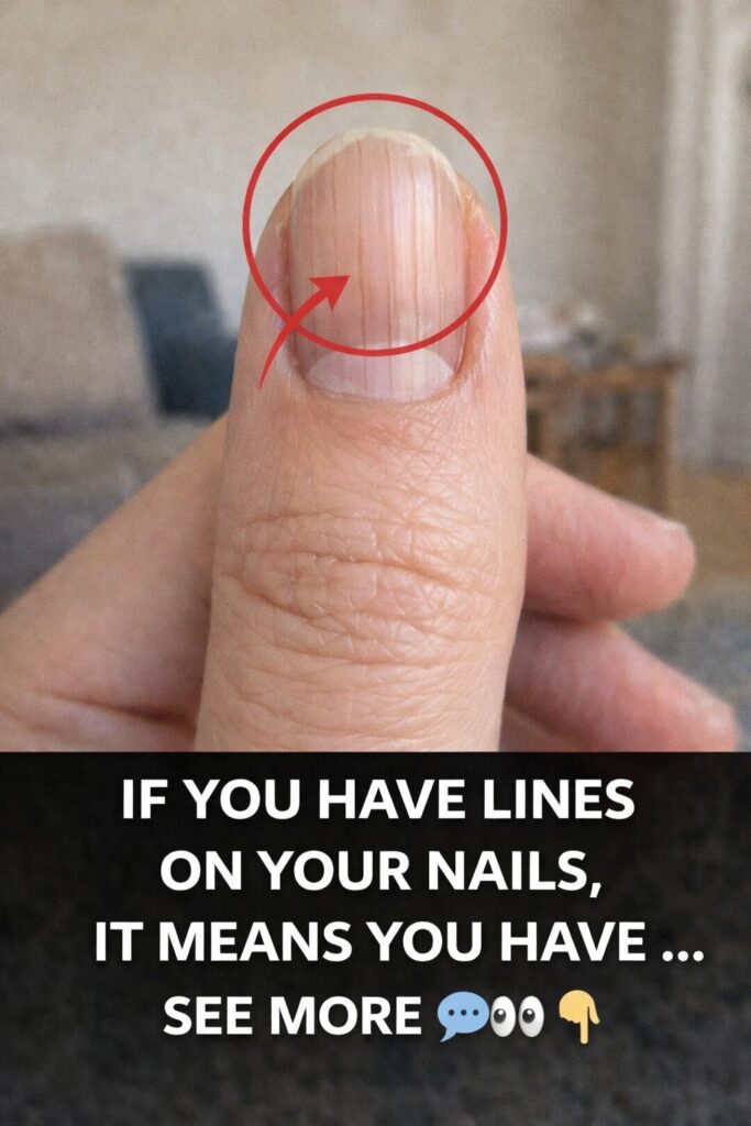 Lines on Your Fingernails: What They Might Reveal About Your Health