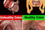 🌙 7 Gentle Nighttime Habits for a Natural Colon Reset