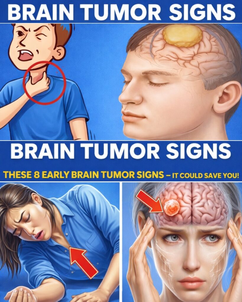 Don’t Miss These 8 Early Signs of a Brain Tumor – Early Detection Can Make a Difference