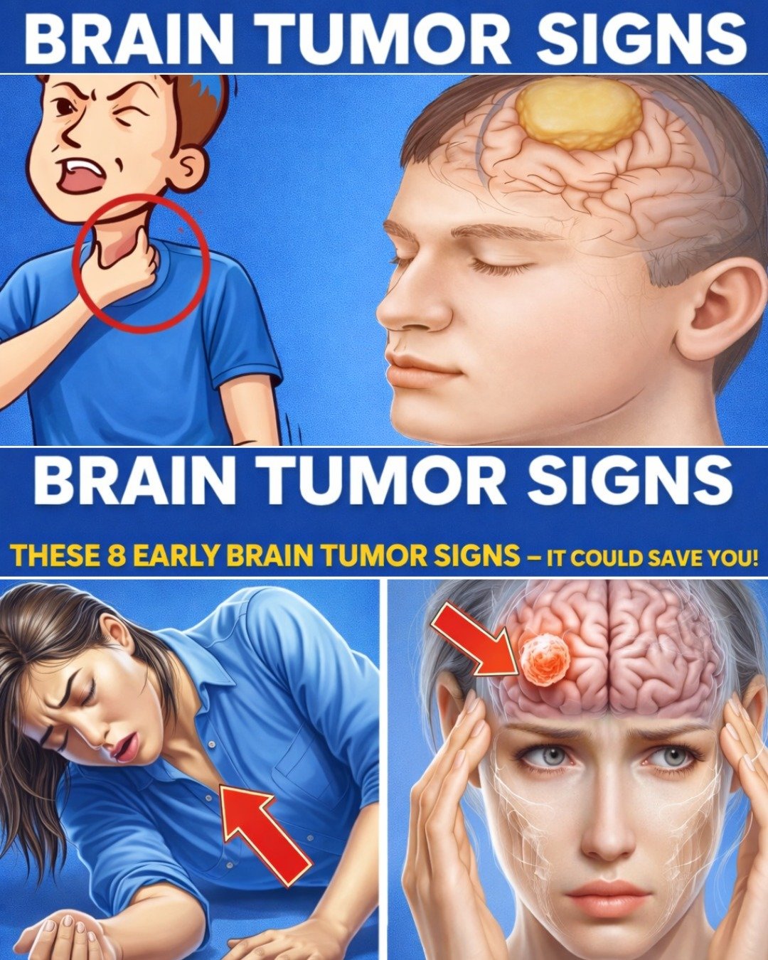 Don’t Miss These 8 Early Signs of a Brain Tumor – Early Detection Can Make a Difference