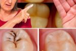Simple Natural Tips to Keep Your Teeth Healthy: 5 Powerful Home Remedies That May Help Prevent Cavities and Reduce Dental Visits