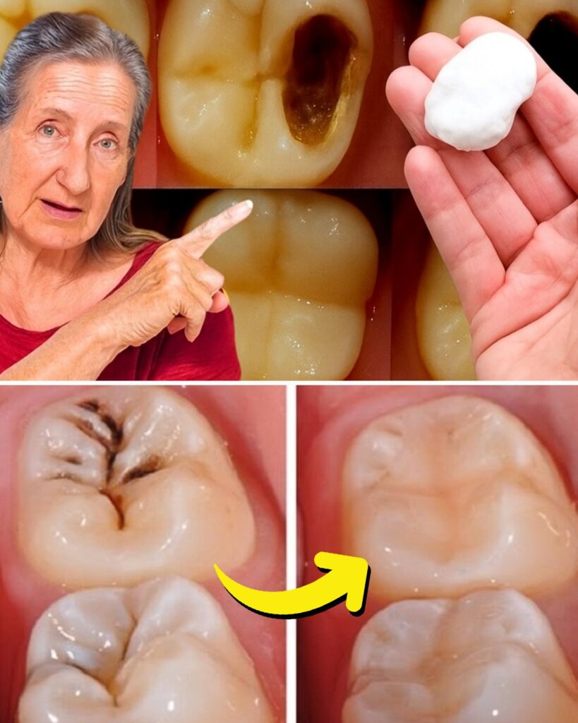 Simple Natural Tips to Keep Your Teeth Healthy: 5 Powerful Home Remedies That May Help Prevent Cavities and Reduce Dental Visits
