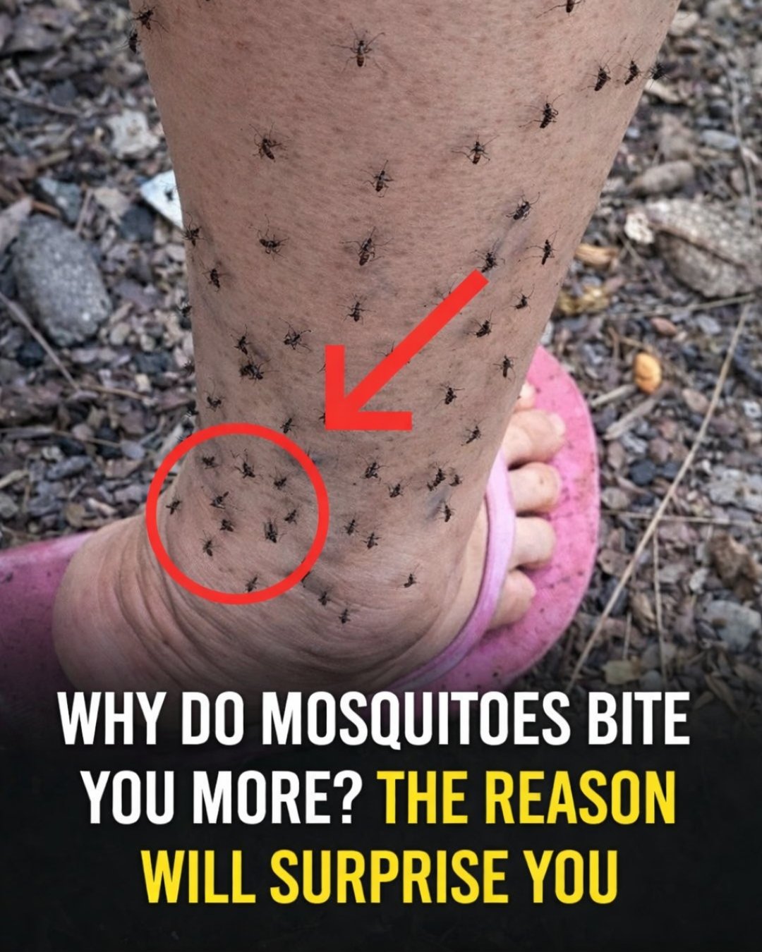 Why Mosquitoes Always Choose You: The Science Behind Their “Favorite Target”