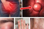 10 Quiet Warning Signs of Colon Cancer You’re Probably Ignoring (Even Doctors Miss #3)
