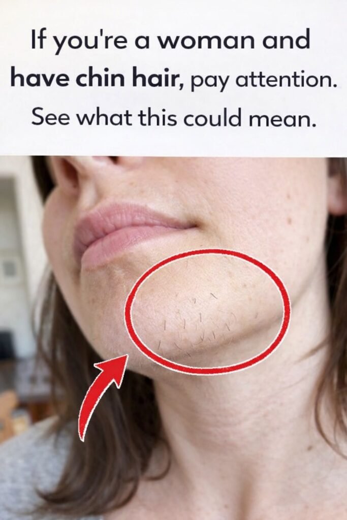 Chin Hair in Women: What It Could Mean for Your Health