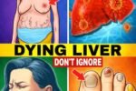 17 Silent Signs Your Liver Is Begging for Help (Even If You Feel “Fine” Right Now)