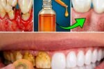 Crazy But Works: Natural Teeth Whitening Methods You Can Try at Home
