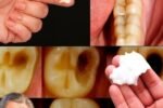 🦷 Natural Ways to Prevent Cavities and Strengthen Your Smile