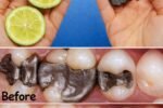 5 Simple Natural Ways to Support Healthy Teeth and Reduce Cavities After 60