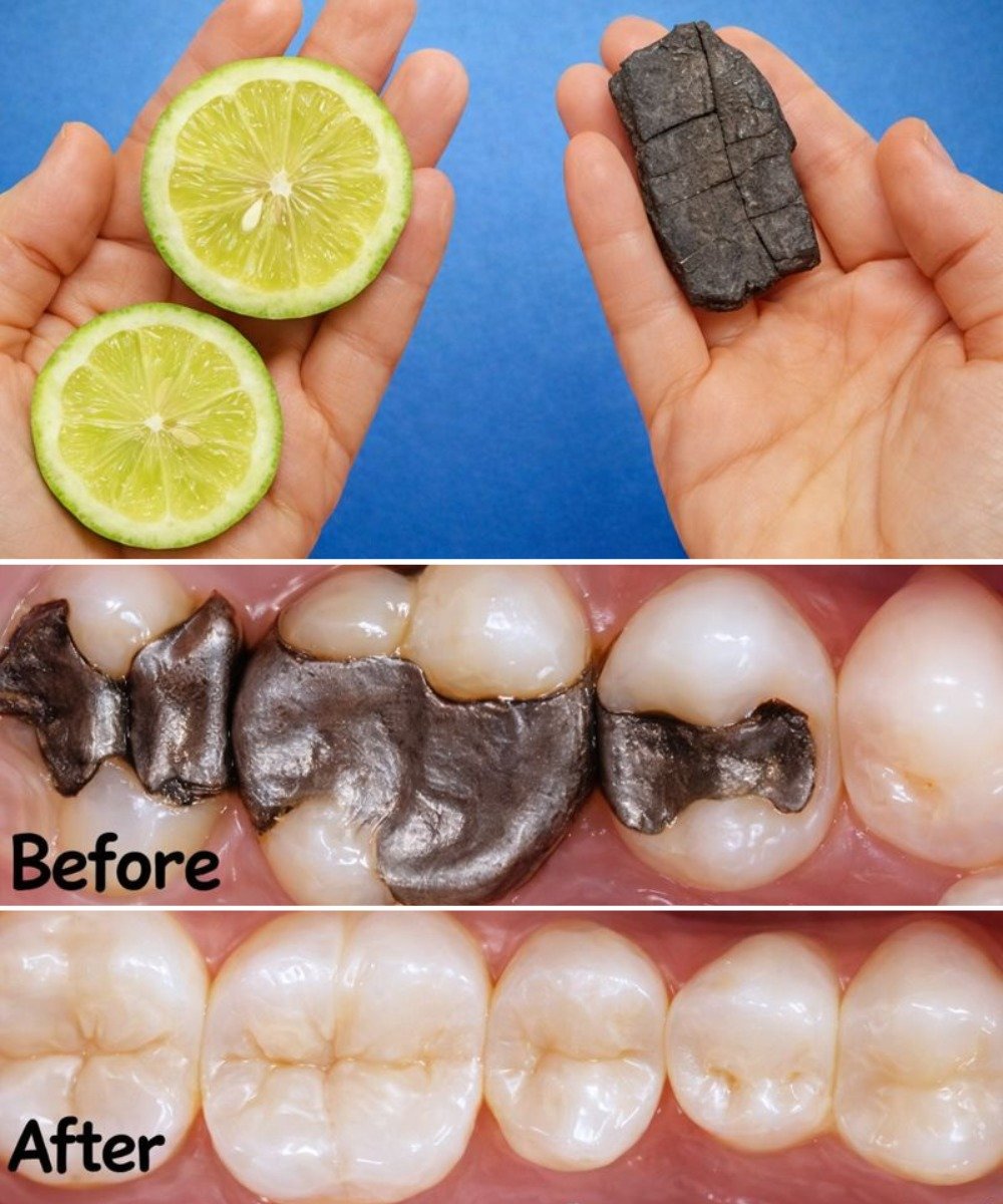 5 Simple Natural Ways to Support Healthy Teeth and Reduce Cavities After 60