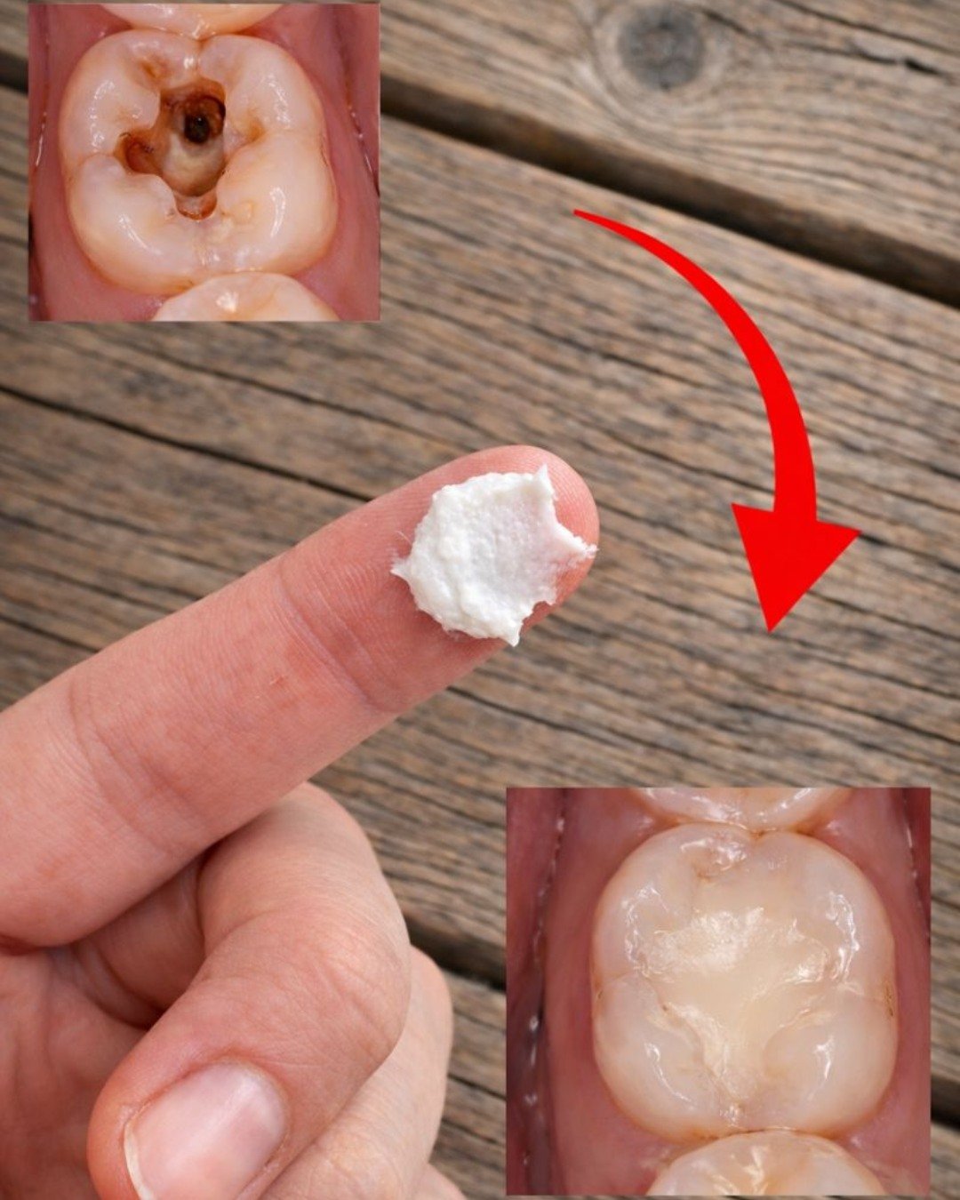 5 Simple Natural Home Remedies to Prevent Cavities and Build Stronger Teeth