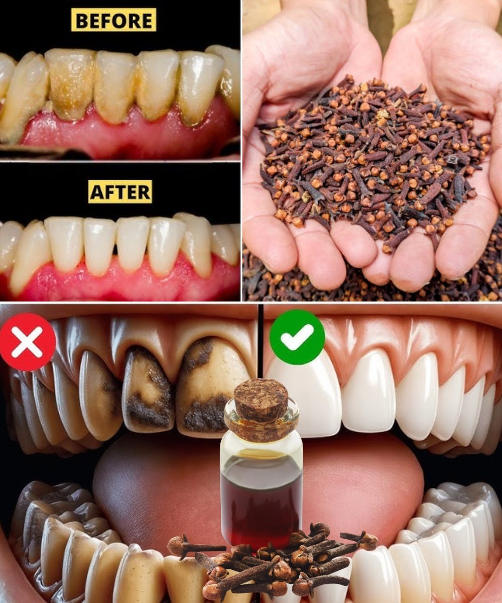 Chewing Cloves Daily: A Gentle Way to Support Healthy Teeth and Gums 🌿🦷