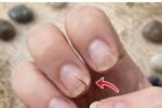 Brittle Nails? 10 Hidden Causes Your Body May Be Signaling – And Simple Ways to Support Stronger Nails