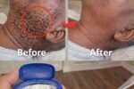 How to Remove Skin Tags in One Night Naturally at Home: The Truth About Vaseline