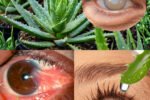 Aloe Vera for Eye Health: Natural Relief for Redness, Dry Eyes, and Irritation