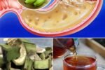 Don’t Throw Away Plantain Peels: A Powerful Natural Remedy for Stomach Problems