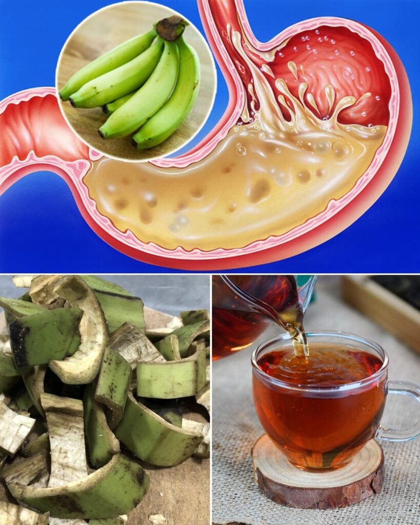Don’t Throw Away Plantain Peels: A Powerful Natural Remedy for Stomach Problems