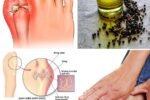 This Oil Quickly Eliminates Uric Acid, Inflammation, Joint Pain, Smoking Cravings, and More
