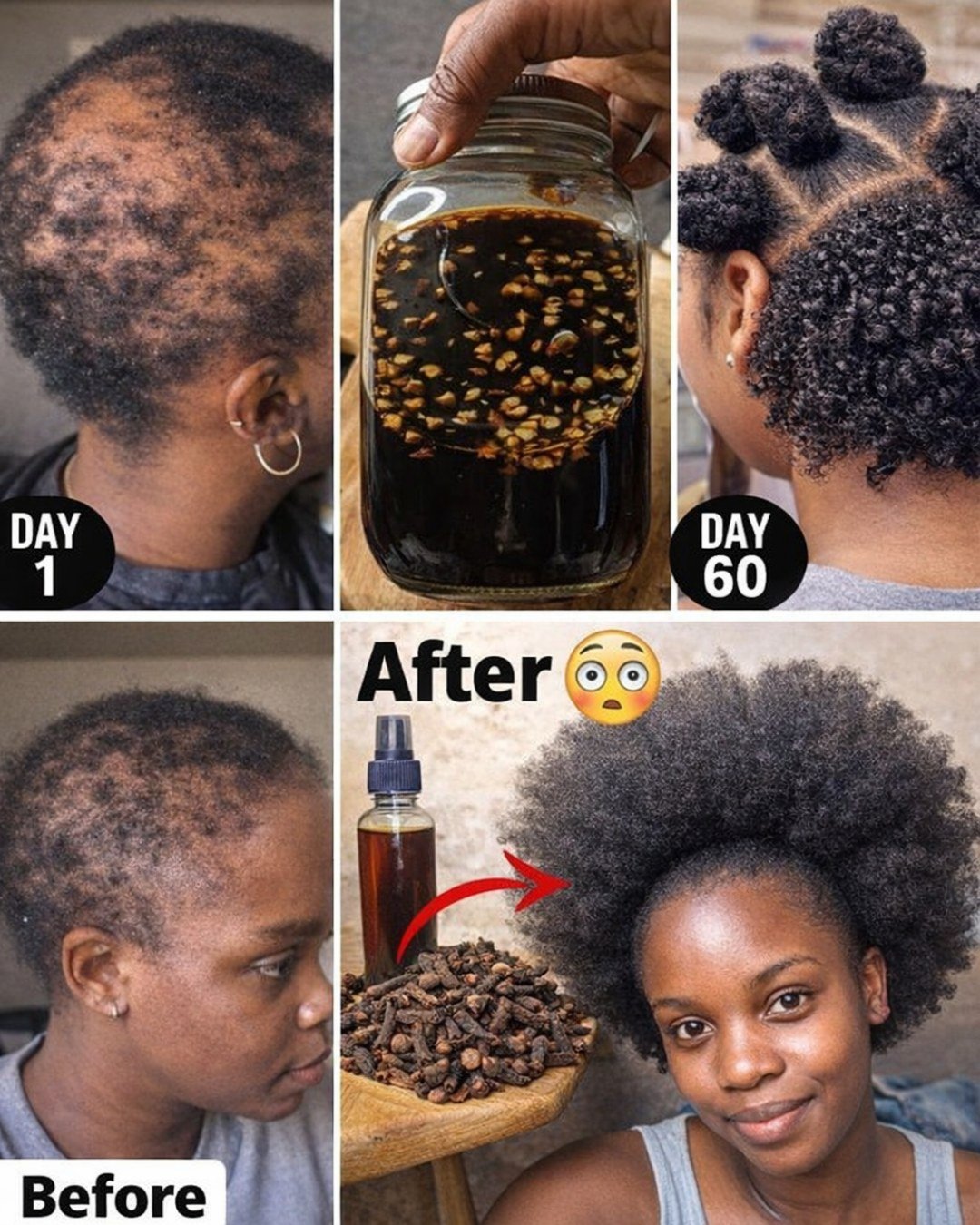 Cloves, Rosemary, and Ginger: The Simple 3-Ingredient Hair Growth Tonic That’s Shocking People (Better Than Aloe Vera?)