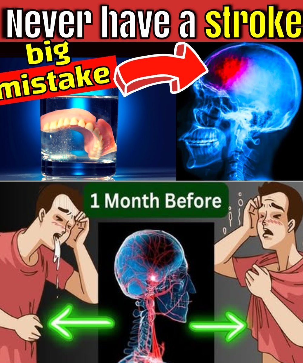 7 MORNING HABITS That Can SAVE You From a STROKE