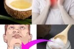 6 Ways Coconut Oil May Benefit People with Thyroid Issues