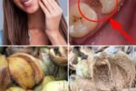 Say Goodbye to Toothache Naturally: The Surprising Power of Coconut Husks