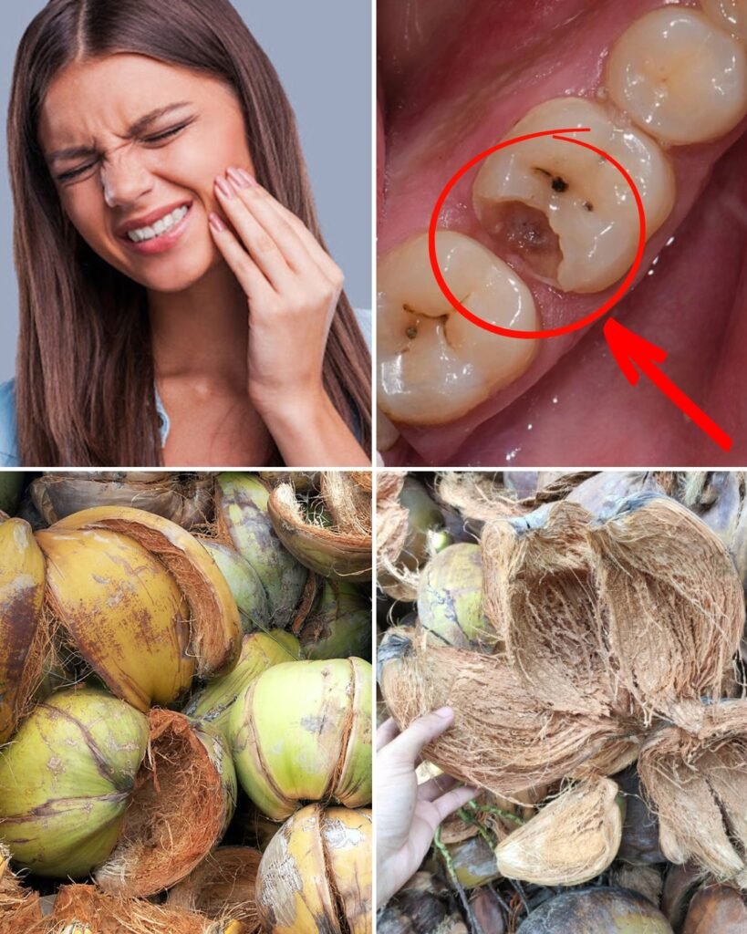 Say Goodbye to Toothache Naturally: The Surprising Power of Coconut Husks