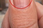 Vertical Lines on Nails: The Silent Sign Many Adults Ignore