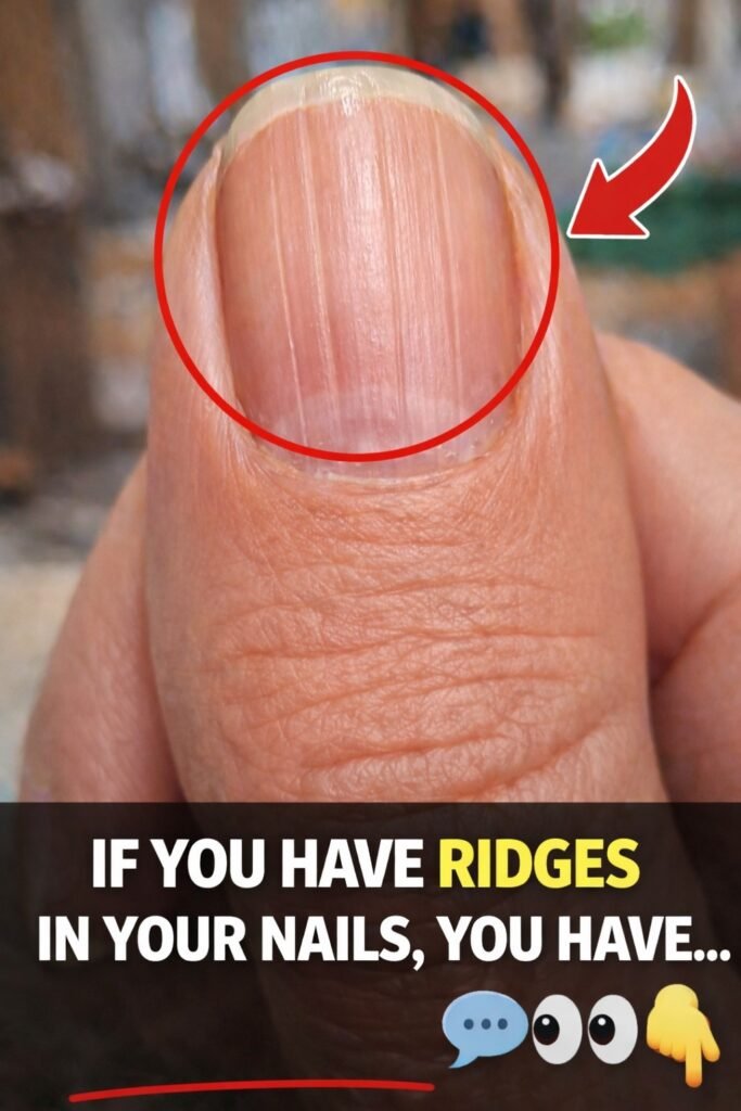 Vertical Lines on Nails: The Silent Sign Many Adults Ignore
