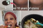 In Just 2 Minutes, Remove 10 Years of Teeth Stains – The Natural Whitener That Actually Works
