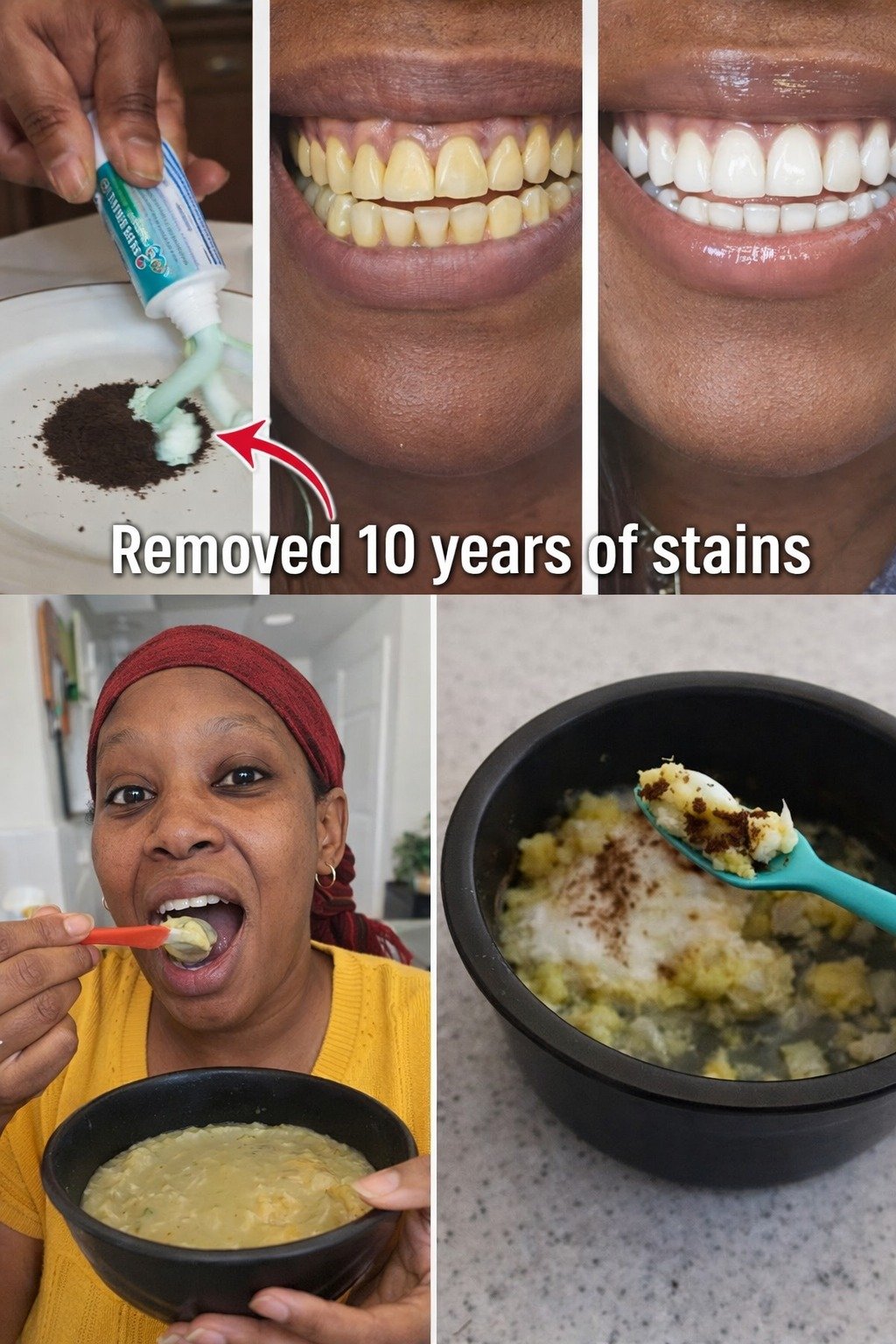 In Just 2 Minutes, Remove 10 Years of Teeth Stains – The Natural Whitener That Actually Works