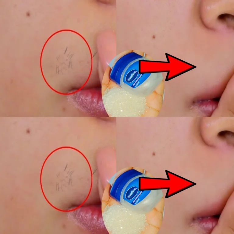 Vaseline for Upper Lip Hair Removal: Can It Permanently Remove Facial Hair?
